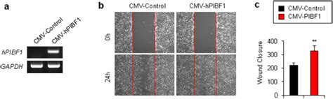 Overexpression Of Human PIBF1 Promotes The Migration Of Murine