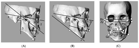 Ijerph Free Full Text Samurai In Japan Class System Related Morphological Differences In