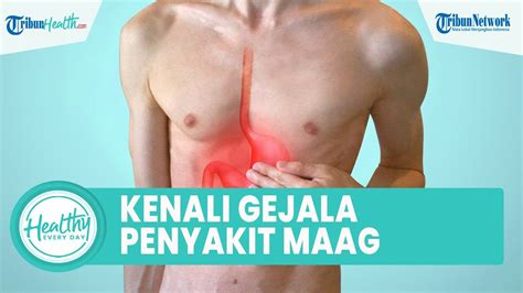 Kenali Gejala Penyakit Maag Yang Kerap Kambuh Diabaikan Sering Sakit