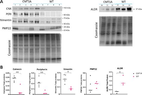 Mouse Anti Vimentin Antibody Agilent Technologies Bioz