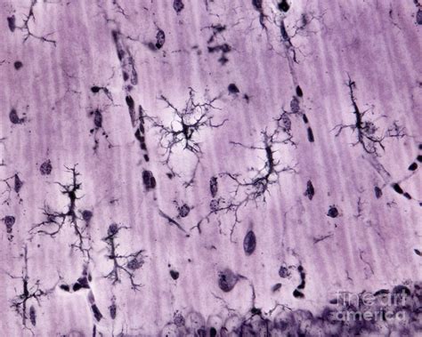 Microglia By Jose Calvo Science Photo Library