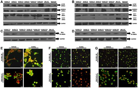 Relationship Between Autophagy Marker Expression And Dynein In The