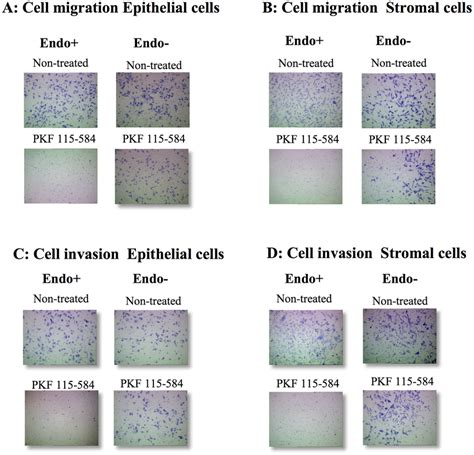 Representative Photomicrographs Of Cell Migration And Invasion A B