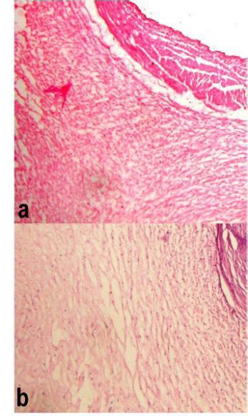 Wharton's jelly area of umbilical cord (a) normal pregnancy (b ...