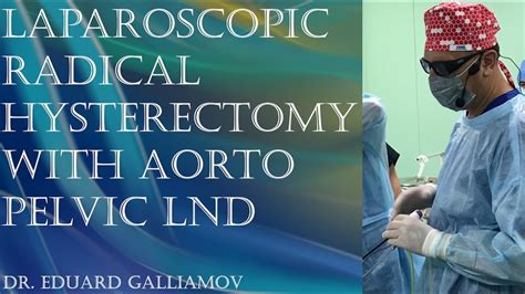 Laparoscopic Radical Hysterectomy With Aorto Pelvic Lnd Радикальная