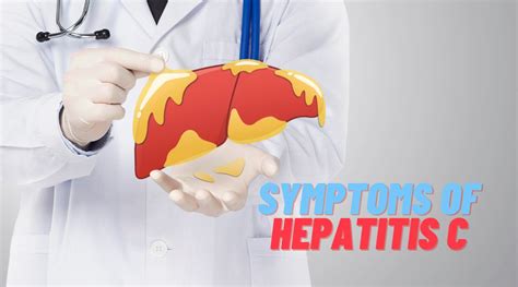 Symptoms of Hepatitis C - World HIV Day