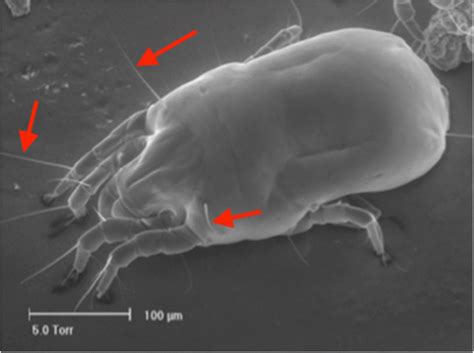 Setae On D Pteronyssinus Mite Arrows Photo © Mission Allergy