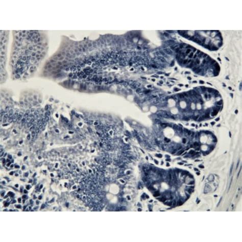 Weigert´s Iron Hematoxylin Stain for staining nuclei