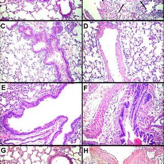 Sample Lung Histology From Balb C Mice Dosed With 100 G Compacted DNA