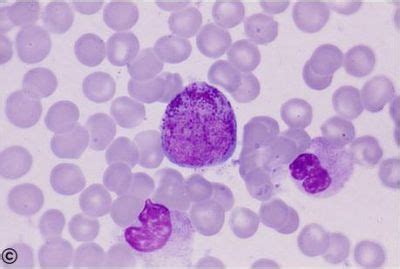 Hematopoiesis and Bone Marrow Histology - Myeloblast - histology slide