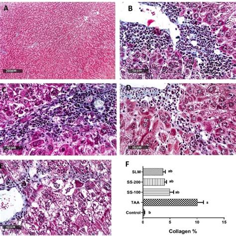 Liver Sections Stained With Masson S Trichrome Stain Of Rats From A