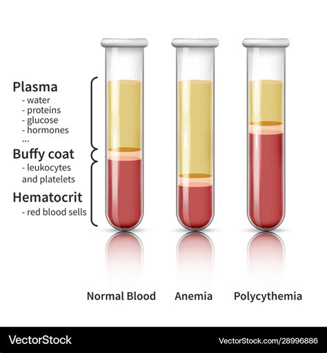 Blood analysis infographic Royalty Free Vector Image