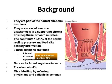 Anal Canal Fissure In Ano Haemorrhoids Dr Amit