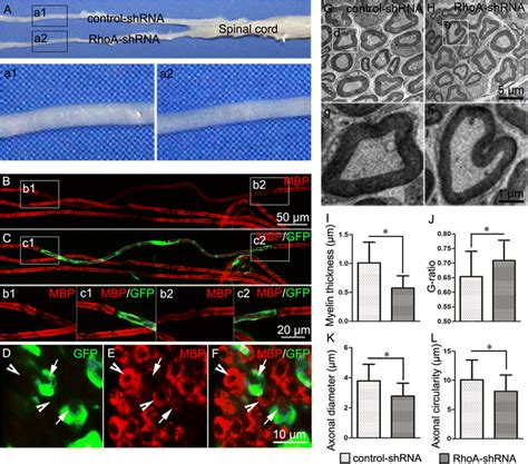 Rhoa Knockdown Results In Hypomyelination Of Transfected Schwann Cells