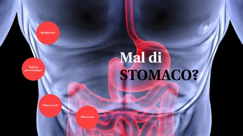 Stomaco E Altre Patologie By Aurora Boccabella On Prezi