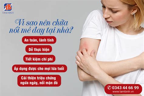 Top 20 Cách Trị Nổi Mề đay Tại Nhà Hiệu Quả Chữa đâu Hết đấy