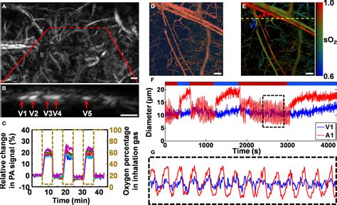 Frontiers Neurovascular Photoacoustic Tomography