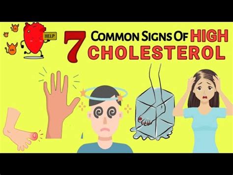 7 Warning Signs Of High Cholesterol You Should Never Ignore High