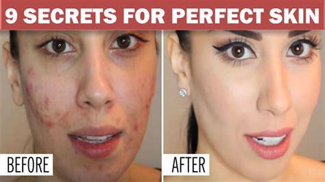 Get Perfect Skin With This Skincare Routine Youtube