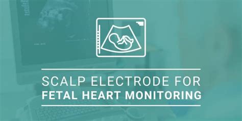 The Scalp Electrode: An Alternative Fetal Heart Monitoring Modality ...