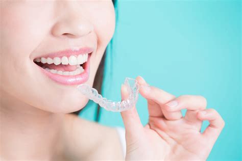 The Benefits Of Invisalign