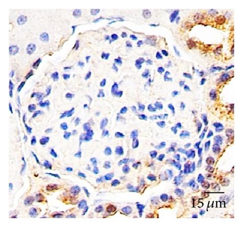 Aqp1 And Hsp60 Expression In The Glomeruli Immunohistochemical