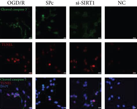 Sevoflurane Postconditioning Attenuated Sirt1 Loss And Cell Apoptosis