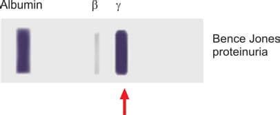 Proteinuria Purpose Test Procedure And Results