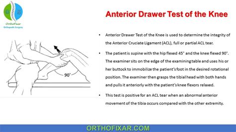 Anterior Drawer Test Knee