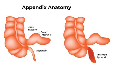 Appendix Drawing