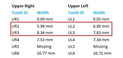 Average Tooth Size Chart