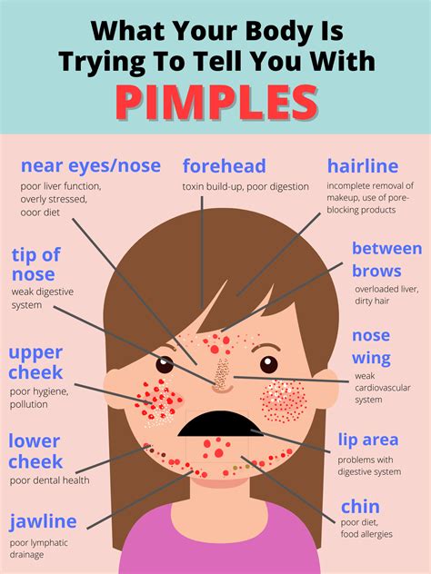 Body Pimple Chart