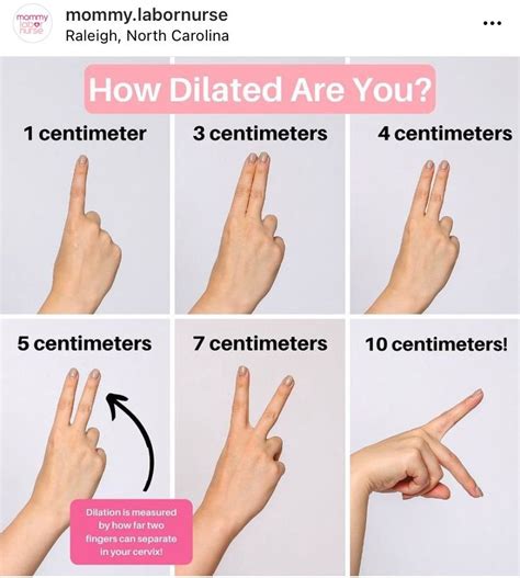 Cervical Dilation Chart Fingers