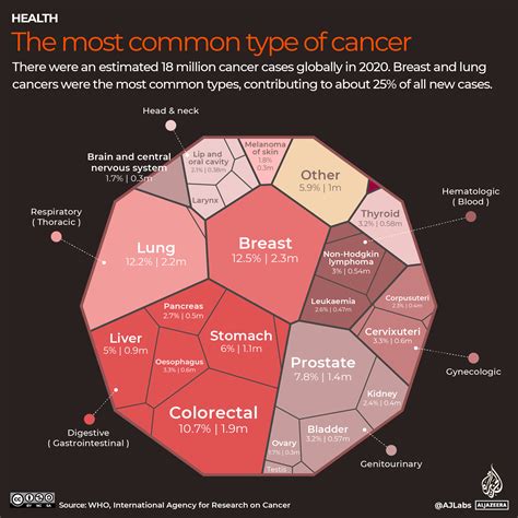 Chart Types Of Eye Cancer