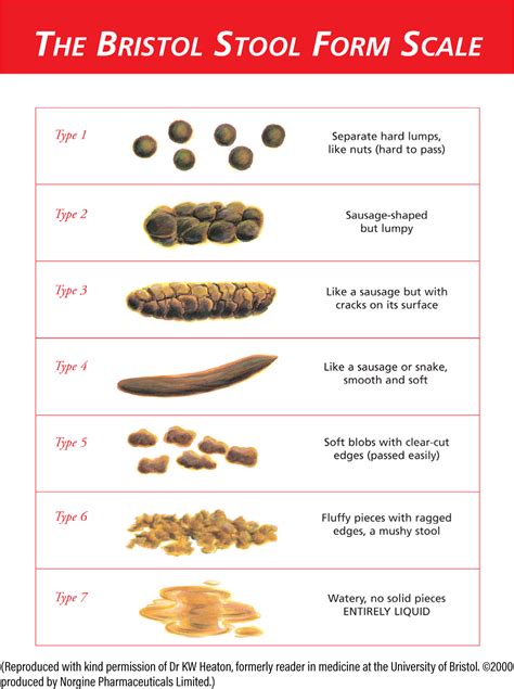 Colon Cancer Poop Chart
