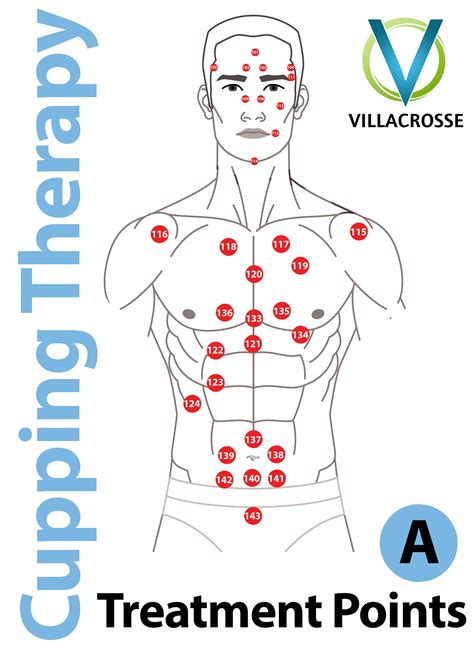 Cupping Placement Chart