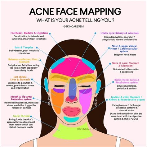 Face Acne Chart
