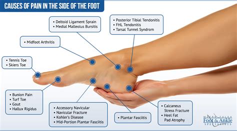 Foot Chart Pain