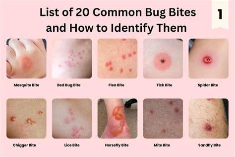 Insect Bite Identification Chart