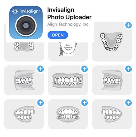 Invisalign Photos Template