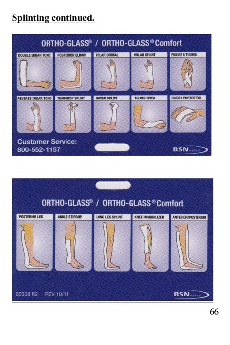 Ortho Glass Splinting Chart