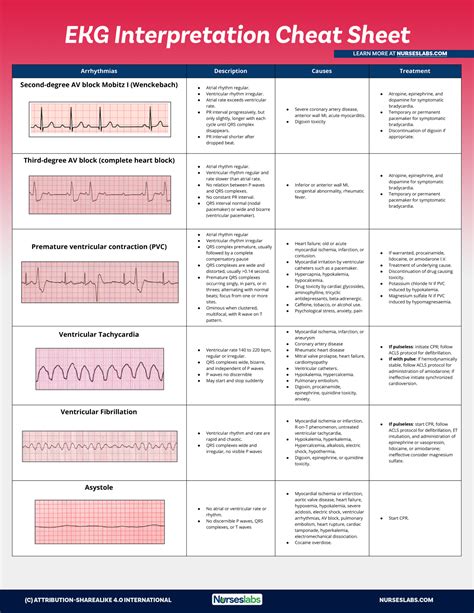Printable 12 Lead Ekg Interpretation Cheat Sheet