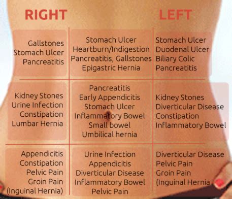 Stomach Pain Chart