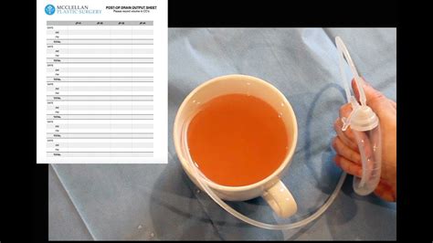 Surgical Drain Fluid Color Chart