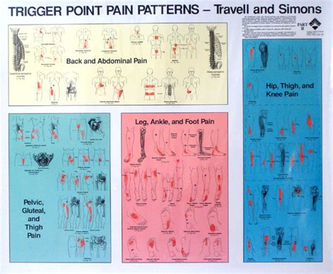 Travell And Simons Trigger Point Chart