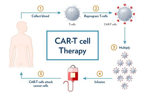 What Is Car T Therapy