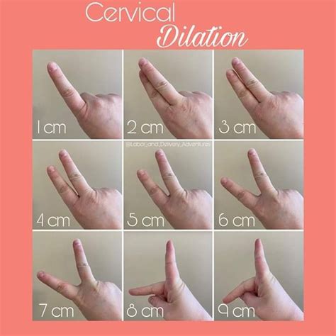 Cm Dilation Chart Fingers