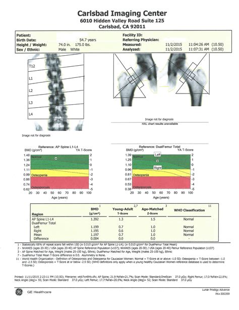 Dexa Scan Chart