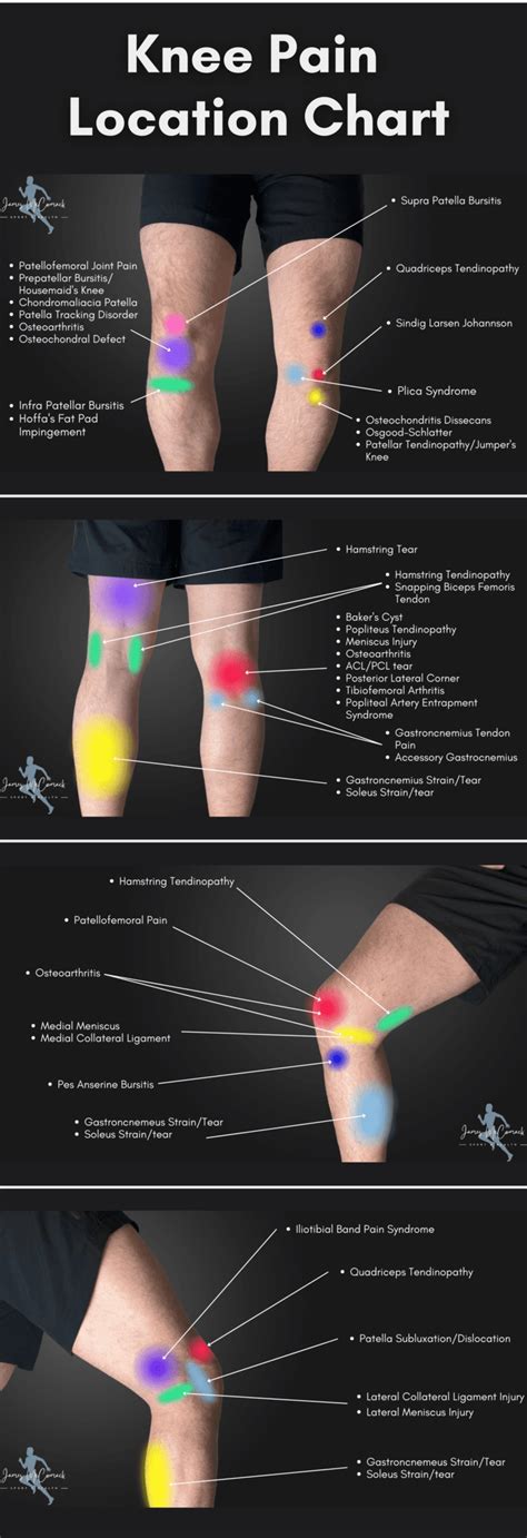 Inner Knee Pain Location Chart