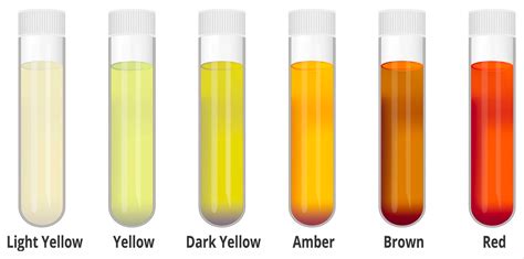 Normal Pee Color Chart